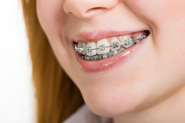 orthodontic treatment